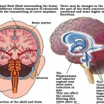 Types of Schizophrenia