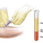 Types of Blood Tests